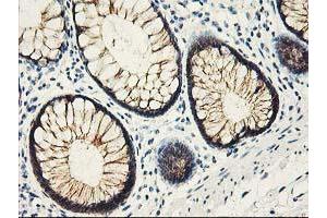 Image no. 1 for anti-Amyloid beta (A4) Precursor Protein-Binding, Family B, Member 3 (APBB3) antibody (ABIN1496653) (APBB3 antibody)