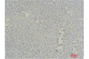 Immunohistochemistry (IHC) analysis of paraffin-embedded Human Tonsil Tissue using Stat4 Polyclonal Antibody. (STAT4 antibody)
