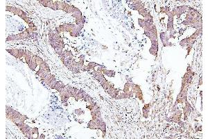 IHC analysis of EIF4A using anti-EIF4A antibody (ABIN7601309). (EIF4A1 antibody  (AA 32-406))