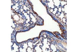 IHC analysis of ALDH1A3 using anti-ALDH1A3 antibody (ABIN5518802). (ALDH1A3 antibody  (AA 37-154))