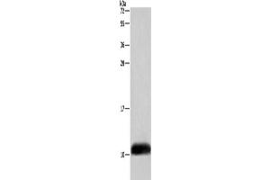 Gel: 10 % SDS-PAGE, Lysate: 40 μg, Lane: A549 cells, Primary antibody: ABIN7129016(COX6B2 Antibody) at dilution 1/500, Secondary antibody: Goat anti rabbit IgG at 1/8000 dilution, Exposure time: 5 seconds (COX6B2 antibody)