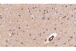 Immunohistochemistry (IHC) image for anti-Caveolin 1, Caveolae Protein, 22kDa (CAV1) (AA 2-104) antibody (ABIN7431320)