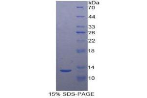 SDS-PAGE (SDS) image for Urotensin 2 (UTS2) (AA 20-120) protein (His tag) (ABIN2122314)
