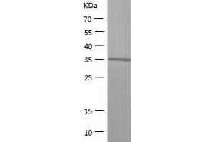 Western Blotting (WB) image for Mitogen-Activated Protein Kinase 9 (MAPK9) (AA 1-382) protein (His tag) (ABIN7123996) (JNK2 Protein (AA 1-382) (His tag))