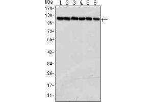 Western blot analysis using PARP mouse mAb against Jurkat (1), K562 (2), Hela (3), Raji (4),THP-1 (5) and SW620 (6) cell lysate. (PARP1 antibody)
