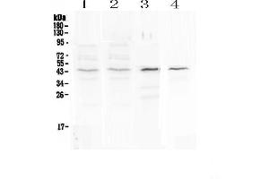 Western blot analysis of SP6 using anti-SP6 antibody . (SP6 antibody)