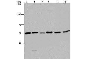 Western Blot analysis of K562, A549, HT-29, 293T, Hela and Jurkat cell using KARS Polyclonal Antibody at dilution of 1:350 (KARS antibody)