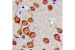 Immunohistochemical analysis of Fusion 1 staining in human brain formalin fixed paraffin embedded tissue section. (TUSC2 antibody  (Center))