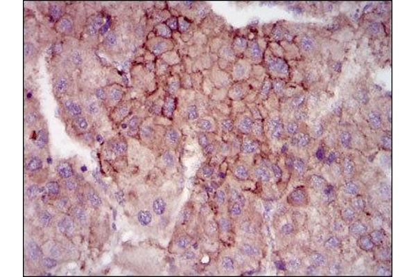 MELK antibody  (AA 637-651)