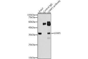 Immunoprecipitation analysis of 300 μg extracts of HeLa cells using 3 μg U2 antibody (ABIN6134442, ABIN6149752, ABIN6149755 and ABIN6217061). (U2AF1 antibody  (AA 1-100))