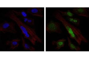 Image no. 1 for anti-SRY (Sex Determining Region Y)-Box 9 (SOX9) antibody (ABIN1501087) (SOX9 antibody)