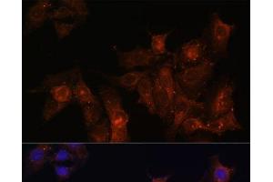 Immunofluorescence analysis of HeLa cells using DMD Polyclonal Antibody at dilution of 1:100. (Dystrophin antibody)