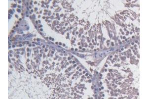 DAB staining on IHC-P; Samples: Rat Testis Tissue) (Fibulin 1 antibody  (AA 347-521))