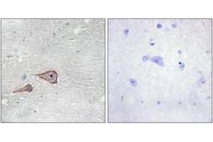 Immunohistochemistry (IHC) image for anti-P-Cadherin (CDH3) (AA 51-100) antibody (ABIN1534295)