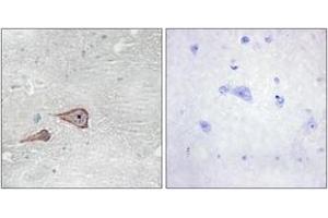 Immunohistochemistry analysis of paraffin-embedded human brain tissue, using CDH3 Antibody. (P-Cadherin antibody  (AA 51-100))