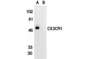 Western blot analysis of CX3CR1 in THP-1 cell lysate in the absence (lane A) or presence (lane B) of blocking peptide with AP30265PU-N CX3CR1 antibody at 1/500 dilution. (CX3CR1 antibody  (Extracellular Loop))