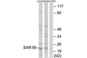 Western blot analysis of extracts from LOVO/RAW264. (SAR1B antibody  (AA 111-160))