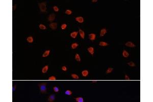 Immunofluorescence analysis of L929 cells using IFT88 Polyclonal Antibody at dilution of 1:100. (IFT88 antibody)
