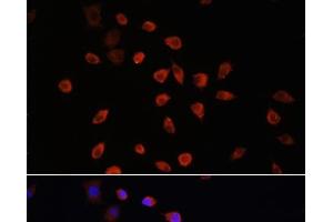 Immunofluorescence analysis of L929 cells using IFT88 Polyclonal Antibody at dilution of 1:100.