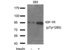 Western blot analysis of extract from 293 cells using IGF-1R(Phospho-Tyr1280) Antibody. (IGF1R antibody  (pTyr1280))