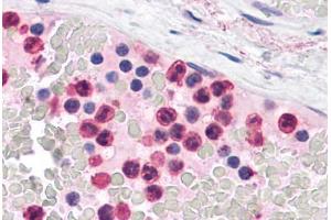 Human Neutrophils: Formalin-Fixed, Paraffin-Embedded (FFPE) (TLR4 antibody  (C-Term))