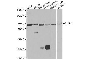 Western blot analysis of extracts of various cell lines, using ALG1 antibody (ABIN5975731) at 1/1000 dilution. (ALG1 antibody)