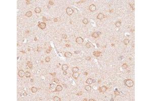 Immunohistochemistry of paraffin-embedded Rat brain using KCNJ4 Polyclonal Antibody at dilution of 1:100 (40x lens). (KCNJ4 antibody)