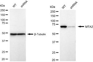 Western blotting analysis using MTA2 antibody (ABIN7799378). (Recombinant MTA2 antibody)