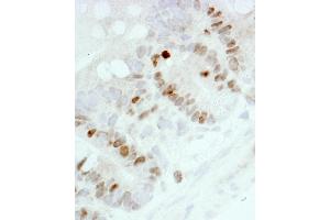 Immunohistochemistry (IHC) image for anti-Antigen Identified By Monoclonal Antibody Ki-67 (MKI67) (AA 1650-1700) antibody (ABIN7448620) (Ki-67 antibody  (AA 1650-1700))