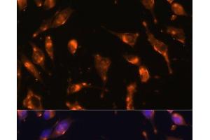 Immunofluorescence analysis of L929 cells using SSTR2 Polyclonal Antibody at dilution of 1:100 (40x lens). (SSTR2 antibody)