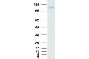 Western Blotting (WB) image for Lysine (K)-Specific Demethylase 6A (KDM6A) protein (Myc-DYKDDDDK Tag) (ABIN2724097)