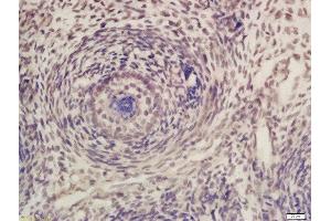 Formalin-fixed and paraffin embedded mouse embryo labeled with Rabbit Anti-CDK7 Polyclonal Antibody, Unconjugated (ABIN670251) at 1:200 followed by conjugation to the secondary antibody and DAB staining (CDK7 antibody  (AA 1-80))