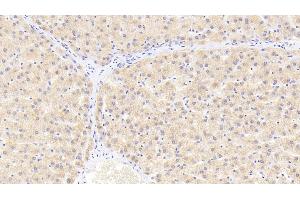 Detection of HSPb2 in Human Liver Tissue using Polyclonal Antibody to Heat Shock Protein Beta 2 (HSPb2) (HSPB2 antibody  (AA 12-182))