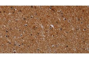 Immunohistochemistry of paraffin-embedded Human brain using CYP1A2 Polyclonal Antibody at dilution of 1:40 (CYP1A2 antibody)