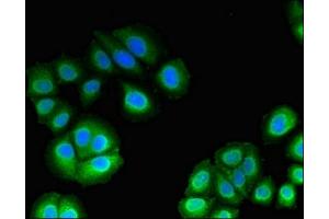 Immunofluorescent analysis of A549 cells using ABIN7174759 at dilution of 1:100 and Alexa Fluor 488-congugated AffiniPure Goat Anti-Rabbit IgG(H+L) (C17orf78 antibody  (AA 1-186))