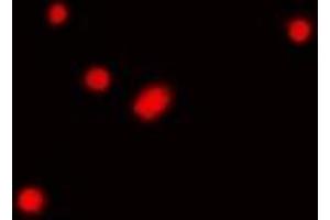 Immunofluorescent analysis of Fibrillarin staining in Hela cells. (Fibrillarin antibody)