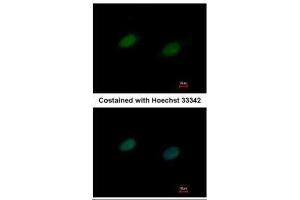 ICC/IF Image Immunofluorescence analysis of paraformaldehyde-fixed HeLa, using UBA2, antibody at 1:500 dilution. (UBA2 antibody  (N-Term))