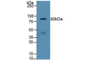 Detection of GSN in Human Serum using Polyclonal Antibody to Gelsolin (GSN) (Gelsolin antibody  (AA 432-625))