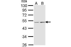 WB Image Sample (30 ug of whole cell lysate) A: A431 , B: Hela 10% SDS PAGE antibody diluted at 1:1000 (COX15 antibody  (Center))