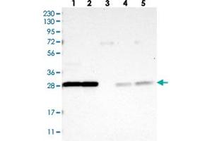 Western blot analysis of Lane 1: RT-4, Lane 2: U-251 MG, Lane 3: Human Plasma, Lane 4: Liver, Lane 5: Tonsil with YWHAQ polyclonal antibody .