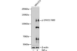 Western blot analysis of extracts of various cell lines, using Phospho-ST-Y690 pAb (ABIN3020024, ABIN3020025, ABIN3020026 and ABIN6225501) at 1:1000 dilution. (STAT2 antibody  (pTyr690))