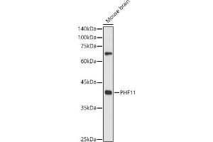 Western blot analysis of extracts of Mouse brain, using PHF11 antibody (ABIN6128437, ABIN6145533, ABIN6145535 and ABIN6217420) at 1:500 dilution. (PHF11 antibody  (AA 1-292))