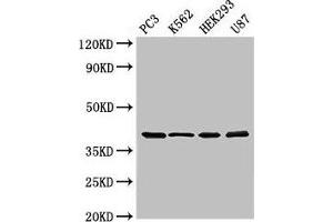 Western Blot Positive WB detected in: PC-3 whole cell lysate, K562 whole cell lysate, HEK293 whole cell lysate, U87 whole cell lysate All lanes: SLAMF1 antibody at 3 μg/mL Secondary Goat polyclonal to rabbit IgG at 1/50000 dilution Predicted band size: 38, 34, 41 kDa Observed band size: 38 kDa (SLAMF1 antibody  (AA 69-204))