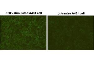 Immunofluorescent staining of EGF-stimulated A431 cells and untreated A431 cells with Phosphotyrosine monoclonal antibody, clone E10 .