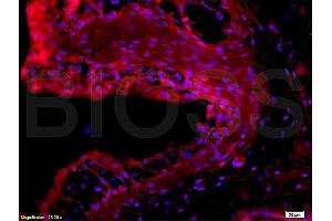 Formalin-fixed and paraffin embedded rabbit bladder tissue labeled with Rabbit Anti-EpCAM/CD326 Polyclonal Antibody (ABIN670611), Unconjugated at 1:200 followed by conjugation to the secondary antibody and DAB staining. (EpCAM antibody  (AA 53-150))