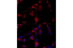 Immunofluorescence (IF) image for anti-Heat Shock Protein 90kDa beta (Grp94), Member 1 (HSP90B1) (AA 550-650) antibody (ABIN6142031)