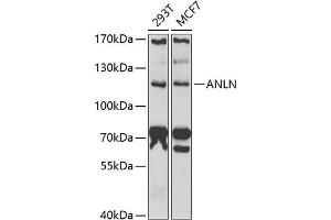 Western blot analysis of extracts of various cell lines, using ANLN antibody (ABIN6127346, ABIN6136899, ABIN6136900 and ABIN6222181) at 1:1000 dilution.