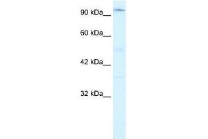 Human Jurkat; WB Suggested Anti-ZNF409 Antibody Titration: 0. (ZFHX2 antibody  (Middle Region))