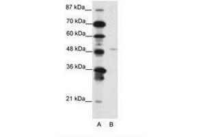 Image no. 1 for anti-Mesenchyme Homeobox 2 (MEOX2) (N-Term) antibody (ABIN202200) (MEOX2 antibody  (N-Term))