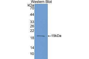 Western blot analysis of the recombinant protein. (NOS1 antibody  (AA 468-616))